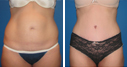 Before & After Photos
